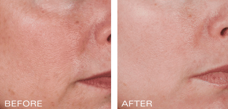 Ossential® Anti-Aging Program