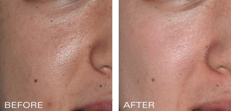 Ossential® Daily Skincare